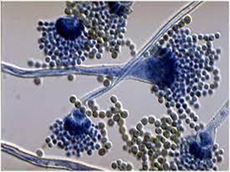 İnvazif Fungal Enfeksiyonlar Çalışma Grubu